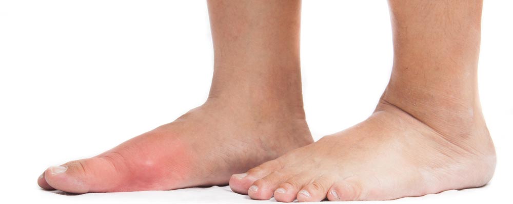Got Big Toe Bumps and Lumps? Here’s 5 Things You Need to Know