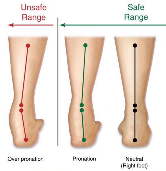 Fun Tips About How To Treat Pronation - Unfuture38