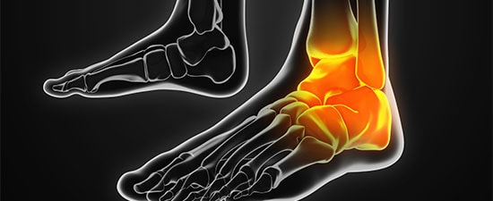 Is Microfracture Obsolete For Osteochondral Lesions Of The Talus?