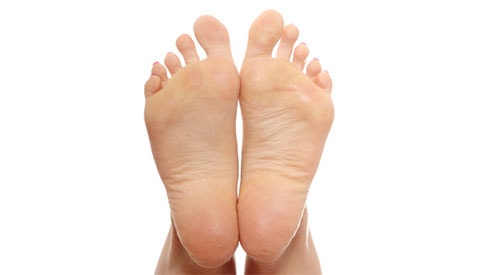 Bunions vs. Big Toe Arthritis, What's the Difference?