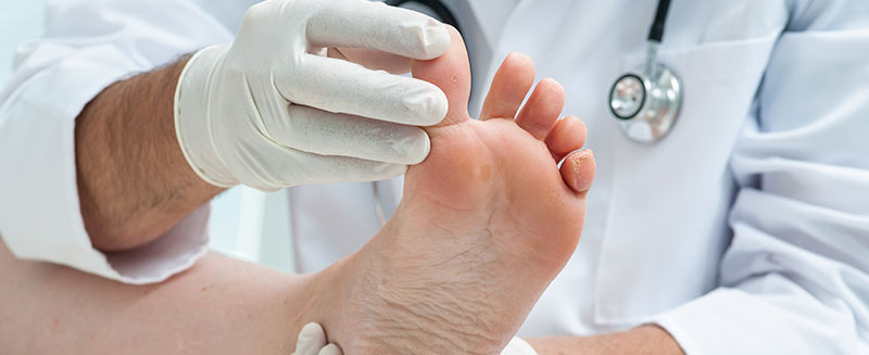 Why Diabetic Foot Exams Are Critically Important