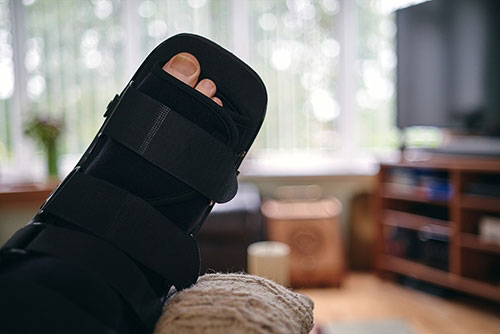 12 Tips to Prepare Your Home for Bunion Surgery Recovery
