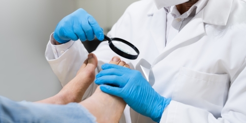 When to See a Doctor for an Ingrown Toenail