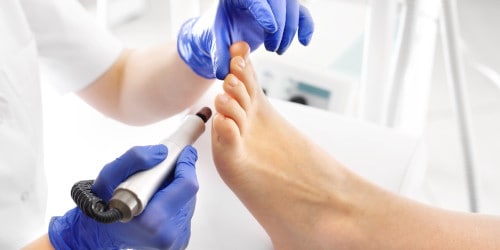 Medical Pedicures: What Are They and Do I Need One?