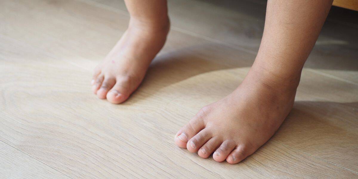 Pediatric Bunion Surgery